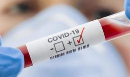 Нови три потвърдени случаи на COVID-19, сред тях е и ученик 