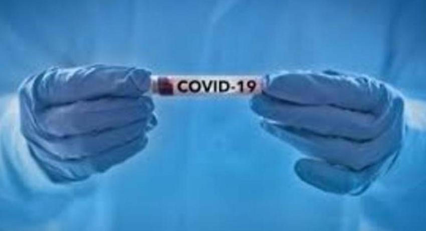 20 нови доказани случаи на COVID-19 в област Разград 