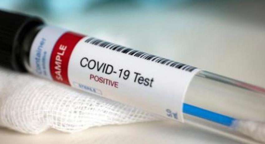 11 нови случая на COVID-19 в област Разград