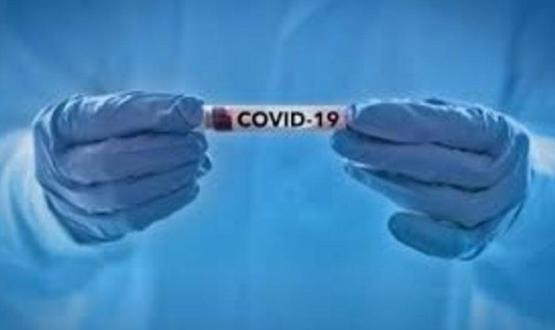21 нови случая на COVID-19 в област Разград