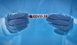 21 нови случая на COVID-19 в област Разград