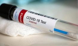 Само 2 нови случая на COVID-19 в област Разград 
