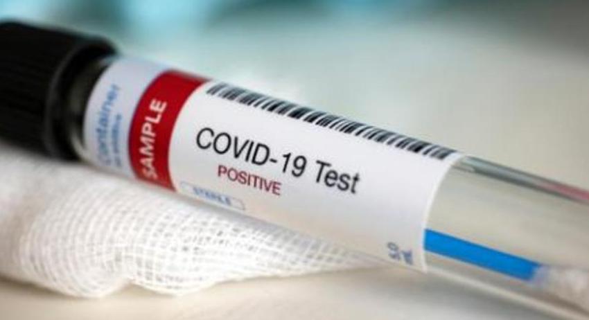 Нови 11 случая на COVID-19 в област  Разград