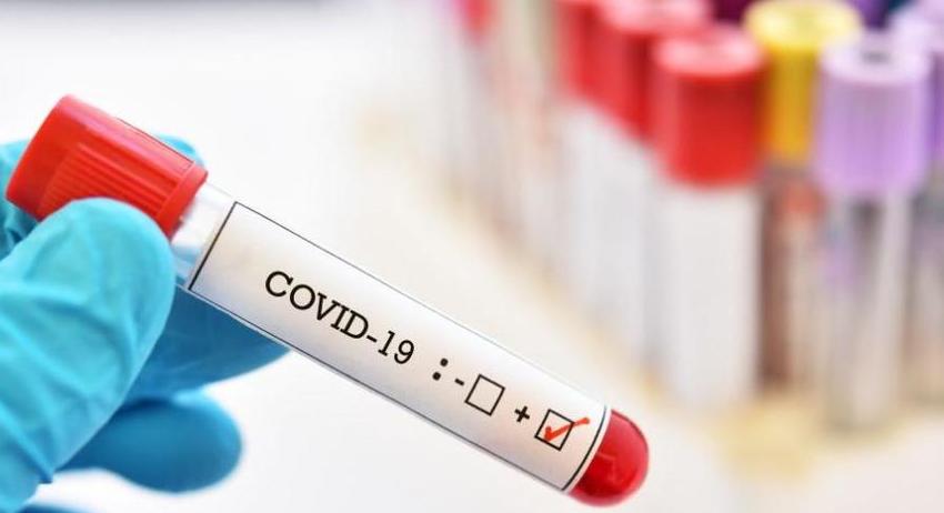 Нови 37 случая на COVID-19 в област  Разград