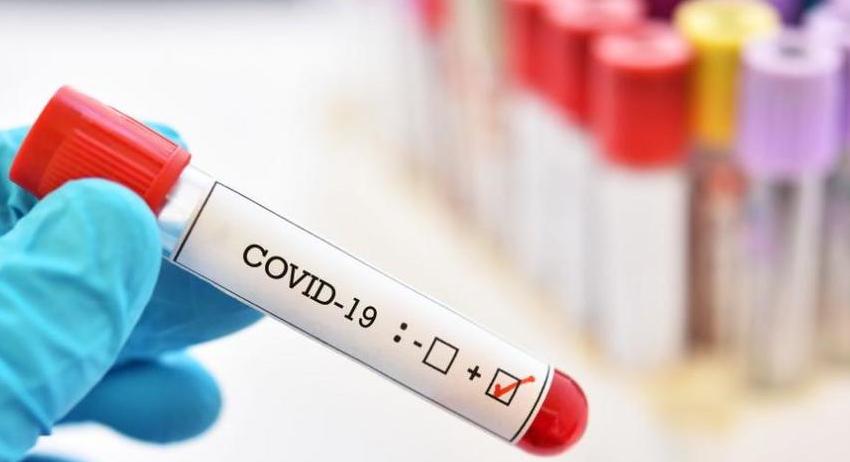 Нови 38 случая на COVID-19 в област  Разград