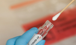 Нови 24 случая на COVID-19 в област  Разград