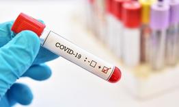 Нови 73 случая на COVID-19 в област  Разград