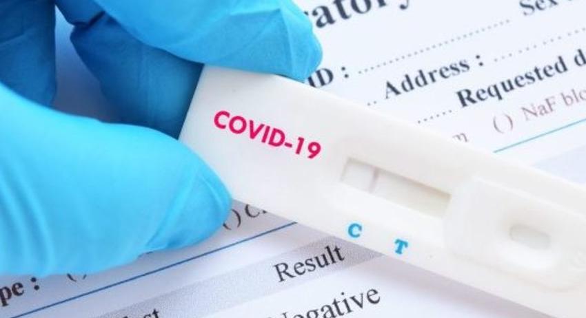 Нови 14 случая на COVID-19 в област  Разград