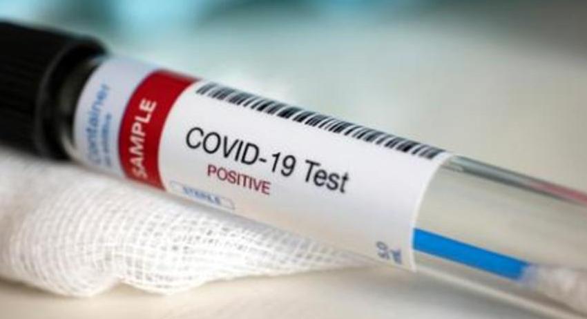 Нови 18 случая на COVID-19 в област  Разград