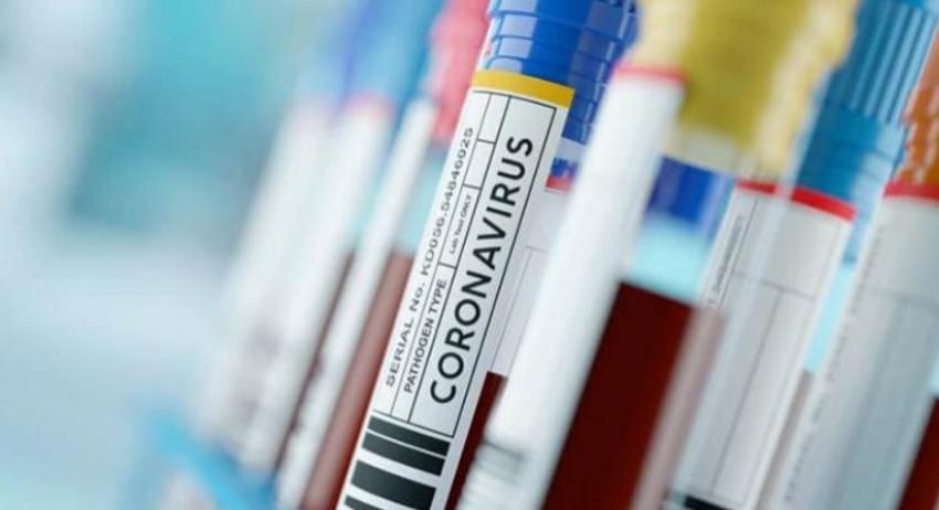 Нови 25 случая на COVID-19 в област  Разград