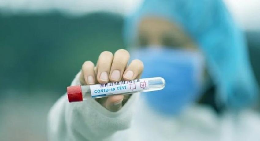 Нови 29 случая на COVID-19 в област  Разград