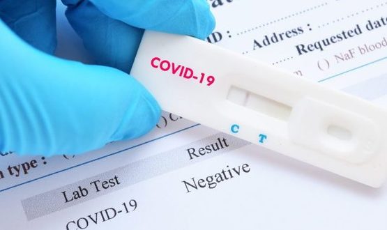Нови 27 случая на COVID-19 в област  Разград
