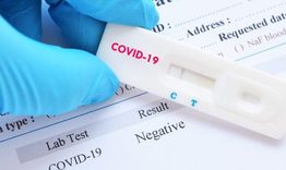 Нови 14 случая на COVID-19 в област  Разград